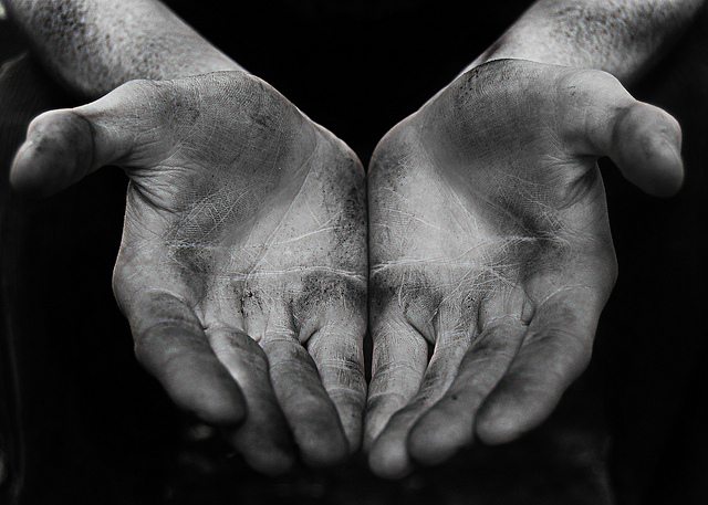 Image of a pair of hand open hands.