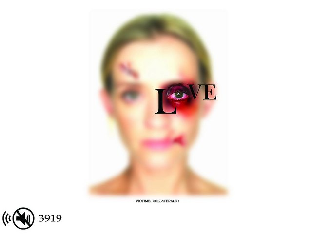 Image of woman with a black eye.